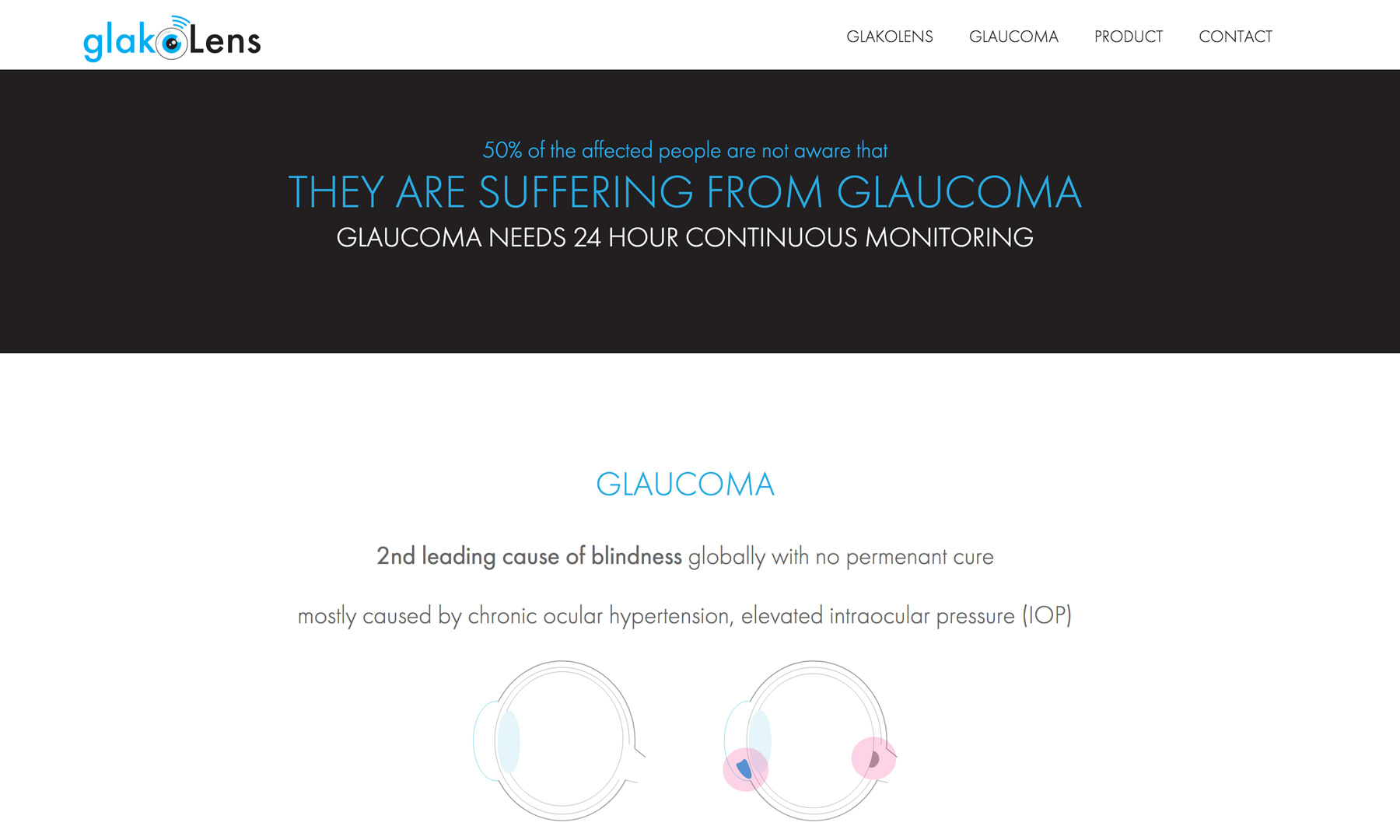 GlakoLens Website